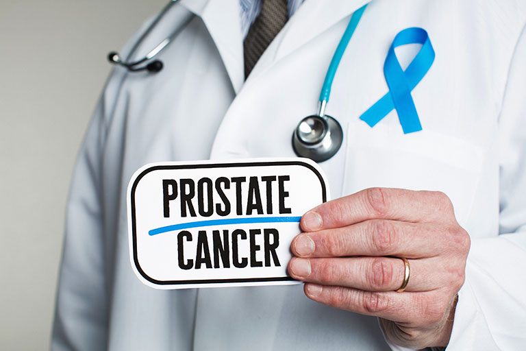 Prostate Cancer - Radical prostatectomy